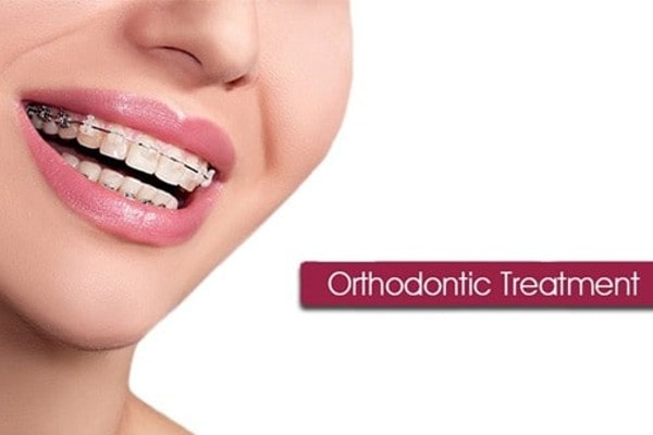 GOrthodontic Treatment