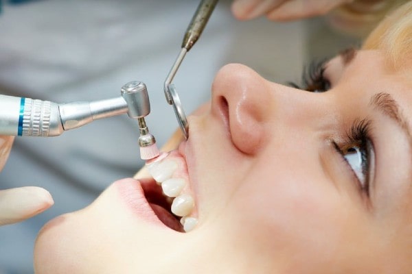 Tooth Cleaning and Polishing