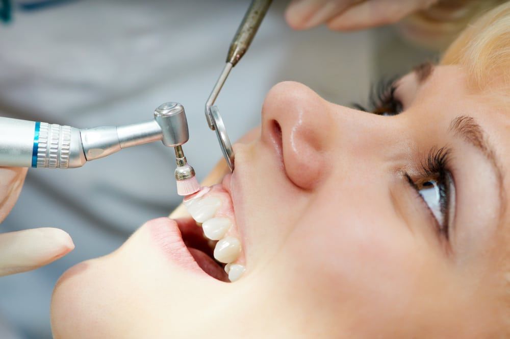 Best Tooth Cleaning and Polishing Dental Clinic  in HSR Layout, Bangalore